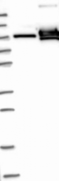 NBP1-81619 - TER ATPase / VCP